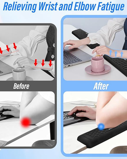 ELZO Desk Elbow Pads (2-Pack) L-Shaped Rest for Desk, Ergonomic Arm Rest Support, Memory Foam Desk Edge Cushion for Palm, Wrist & Forearm, Prevents Elbow & Wrist Strain