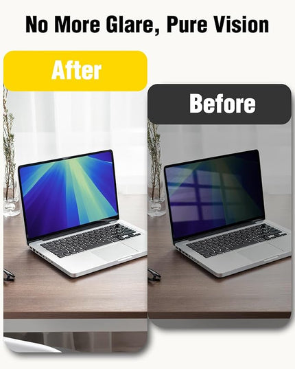 F FORITO Magnetic Privacy Screen Protector Compatible with MacBook Air 13 inch (2018, 2019, 2020, 2021, M1), Removable 360° Anti Peeping Anti Blue Light Laptop Privacy Shield